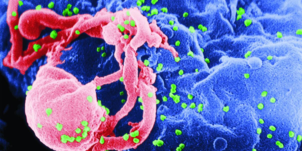 illustration of a cell infected with HIV
