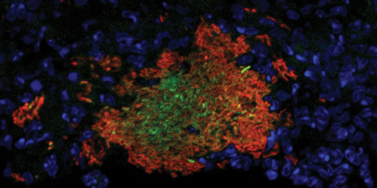 Yersinia replicating in the mouse spleen. Slow-growing bacteria responding to nitric oxide (red) protect interior bacteria (green). Neutrophils (blue) surround the bacterial cluster. Image courtesy of Kim Davis.