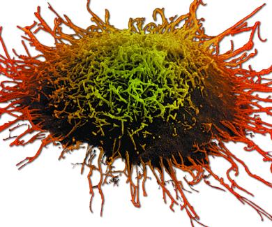 large microscopy image of a cervical cancer cell