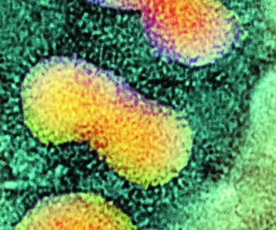 H5N1 avian flu virus particles magnified 500,000 times